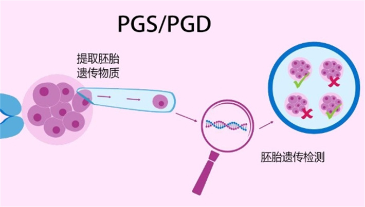 pgs,pgd美国试管技术