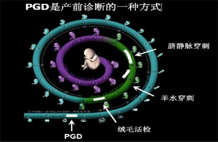 pgd基因检测