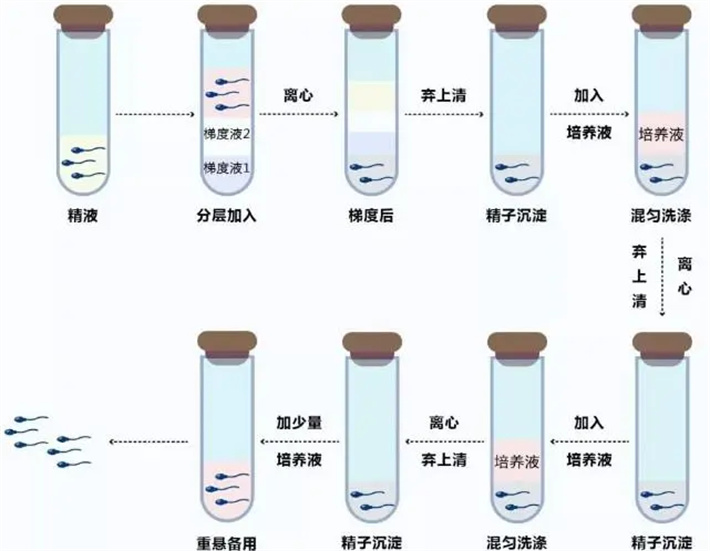 Perecoll精子洗涤技术