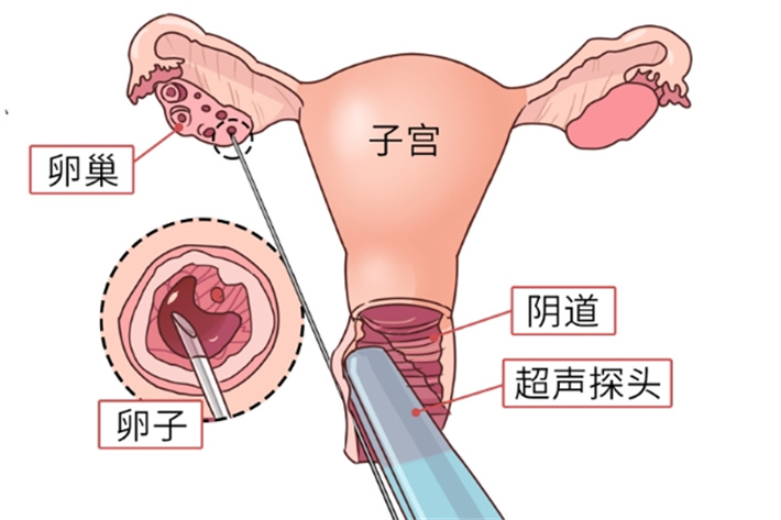 取卵2.jpg