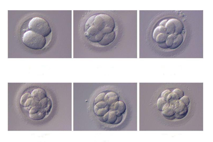 胚胎等级划分