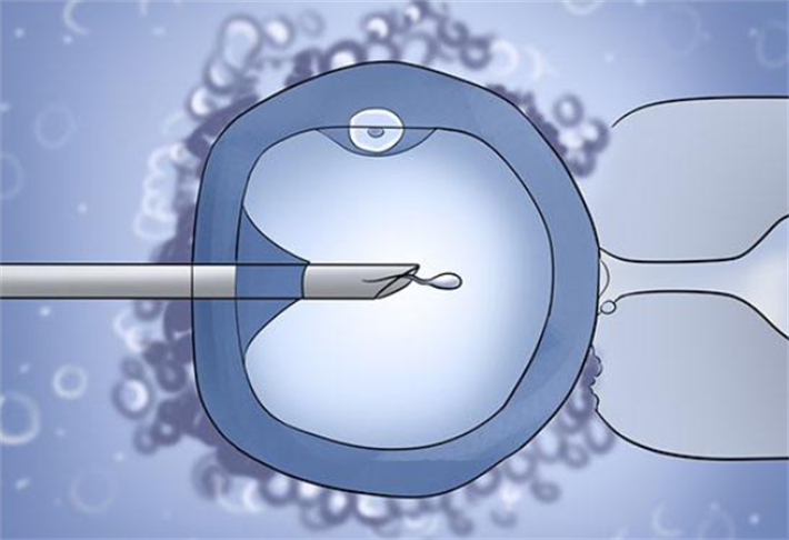 单精子注射技术
